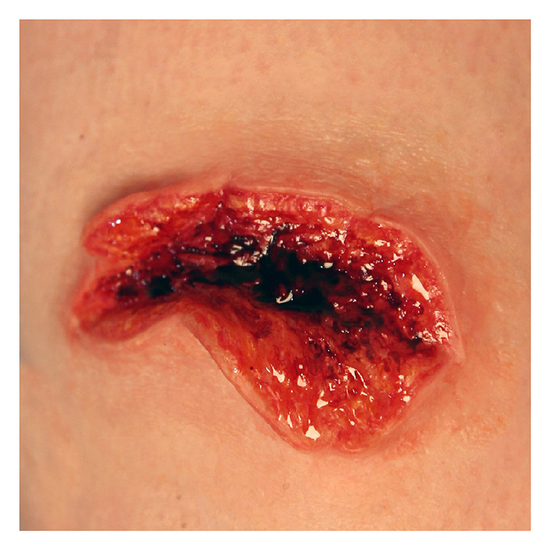 P.T.M -  Silicone Mold - Avulsion LARGE P.T.M -  Silicone Mold - Avulsion LARGE