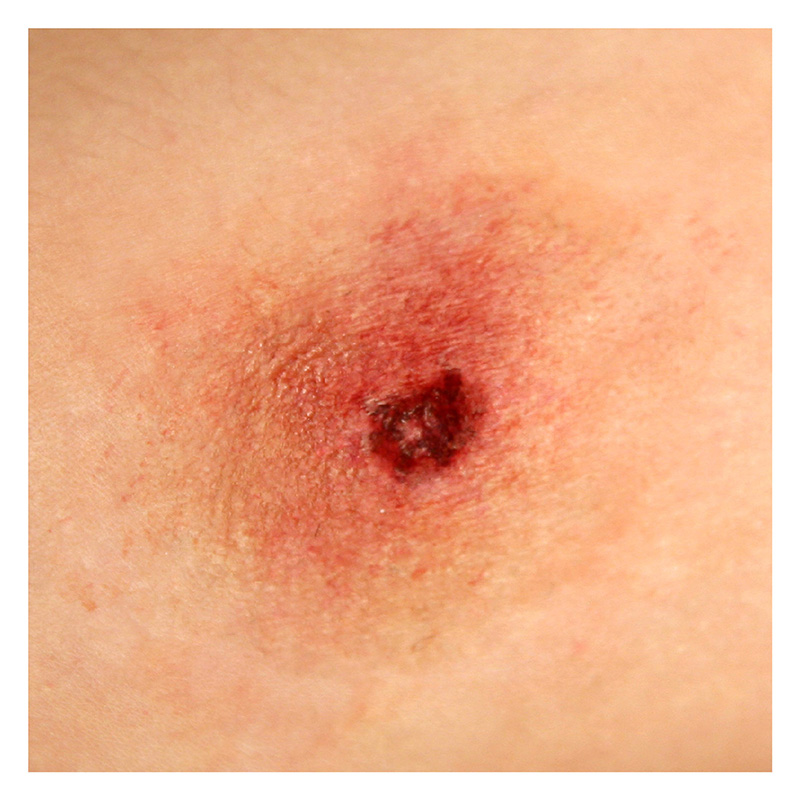 P.T.M -  Silicone Mold - Bullet Hole Entry 002 9mm Caliber7 P.T.M -  Silicone Mold - Bullet Hole Entry 002 9mm Caliber7