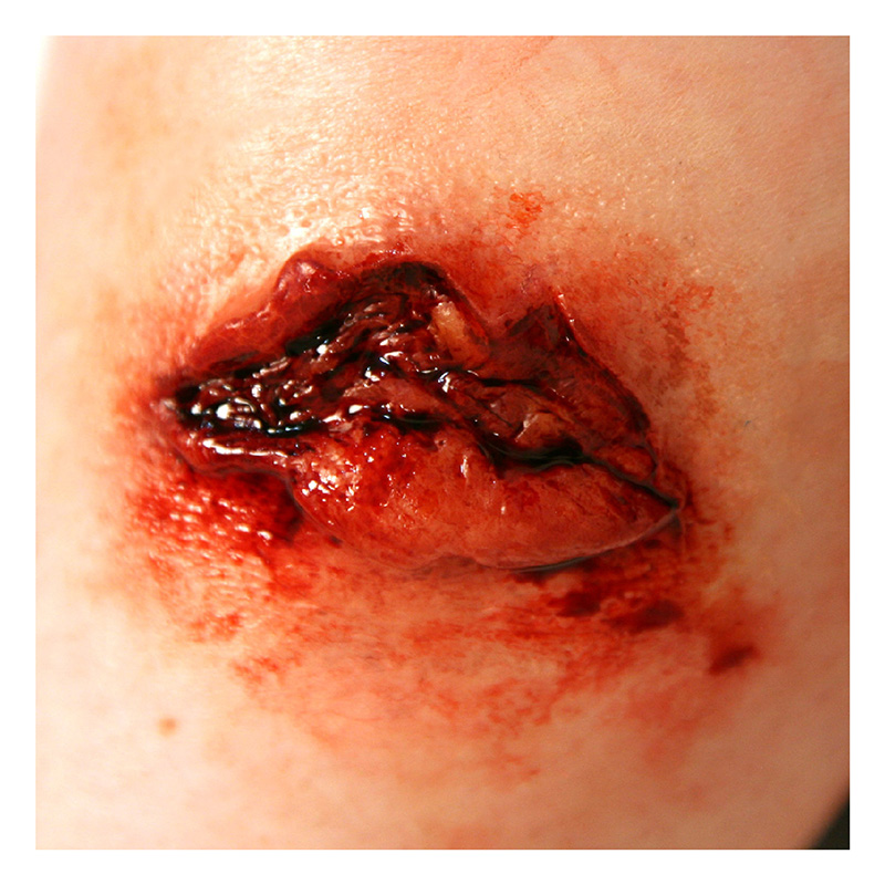 P.T.M -  Silicone Mold - Avulsion MEDIUM P.T.M -  Silicone Mold - Avulsion MEDIUM